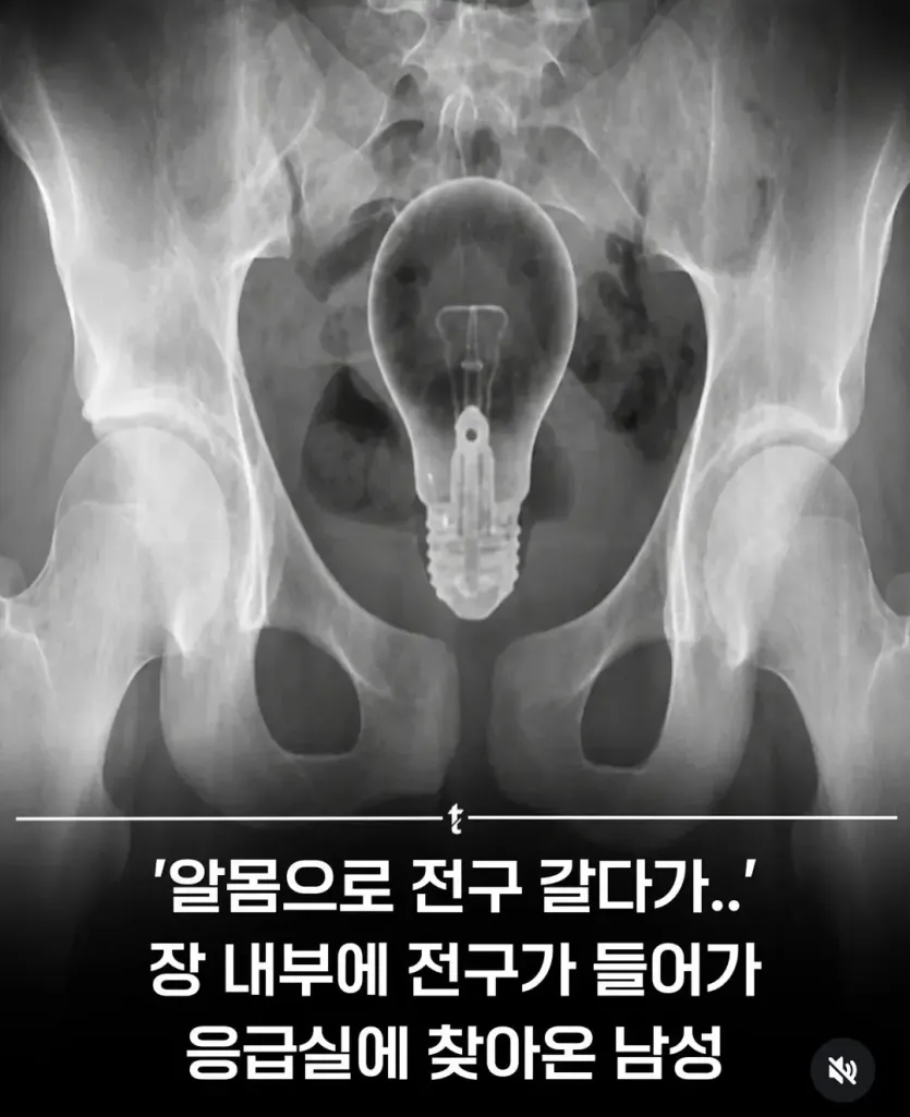 1000022170.jpg &quot; 의외로 진짜 위험한 행동 ...... &quot; . JPG