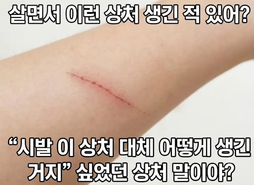 image.png 왜 생겼는지 모르겠는 상처 순위권 (번역)